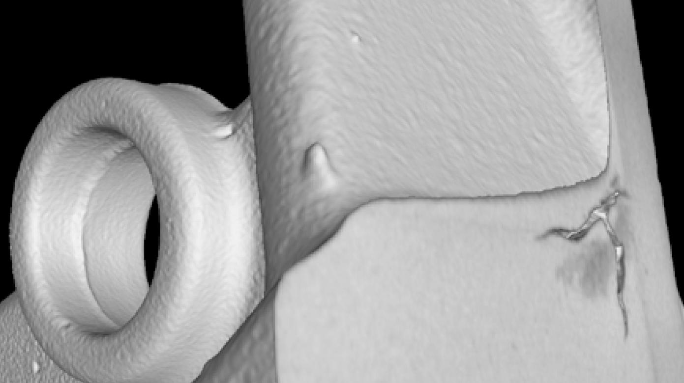 Áreas esponjosas de metal leve da ZEISS