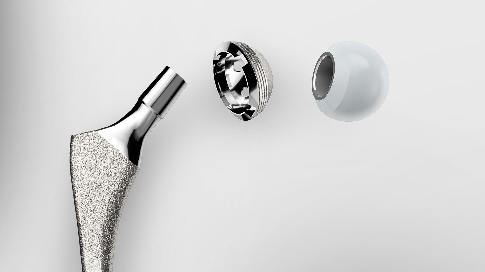 Descubra as barreiras de qualidade e as soluções para o processo de produção de implantes ortopédicos