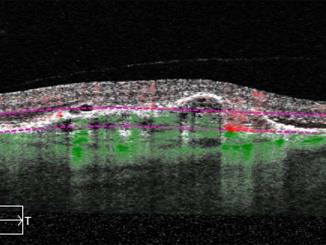 Reveal the finer details of the retinal microvasculature