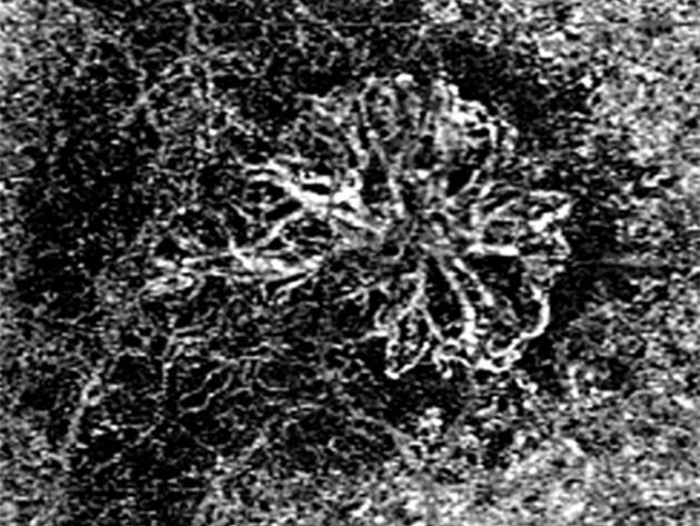 Reveal the finer details of the retinal microvasculature