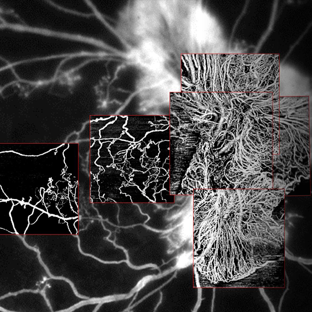 Visualize vascular abnormalities
