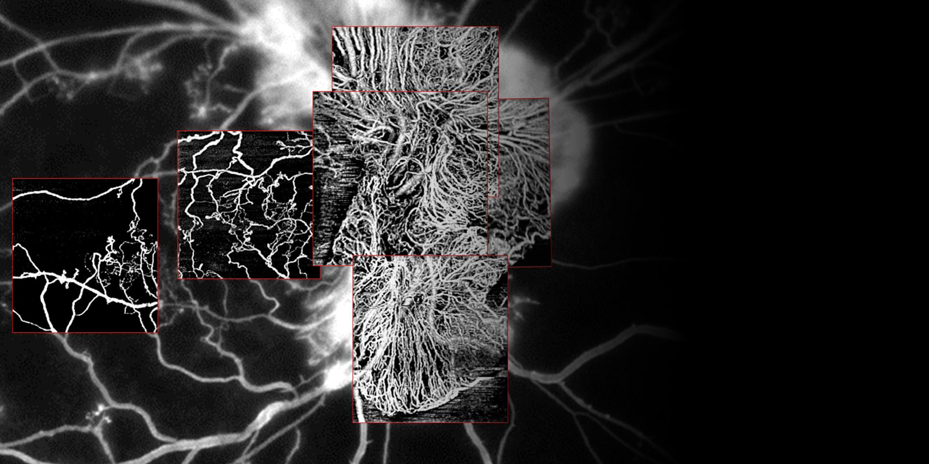 Visualize vascular abnormalities