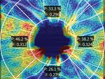 Gain new insights into glaucoma and retinal conditions