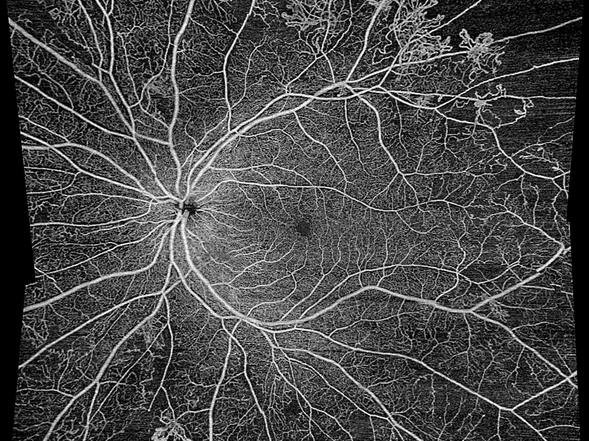 See wider for a quick vascular assessment