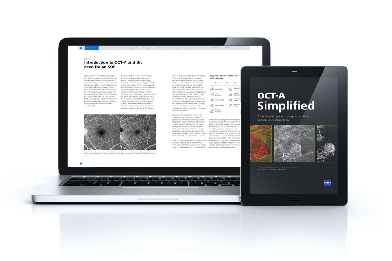 Preview of the ebook OCT-A simplified in an laptop and iPad