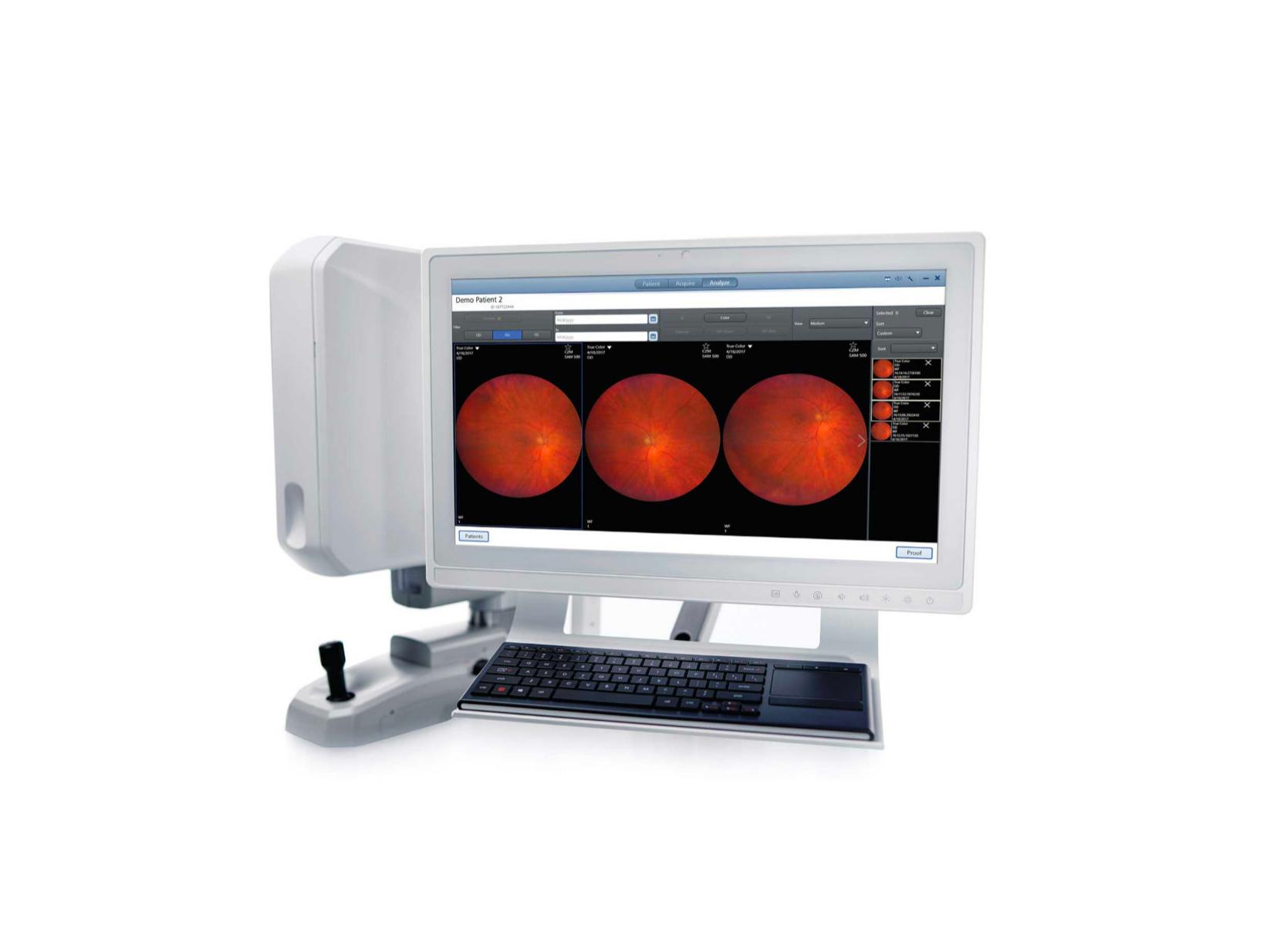 Câmeras de retina da ZEISS