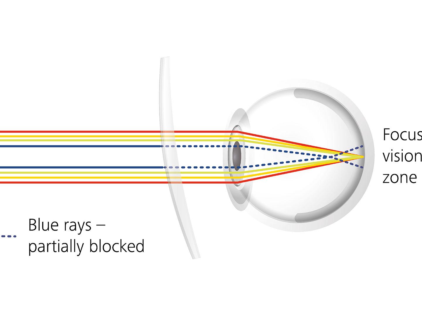 Visualização do modo como os tratamentos de lentes podem reduzir o ofuscamento bloqueando parcialmente os raios azuis 