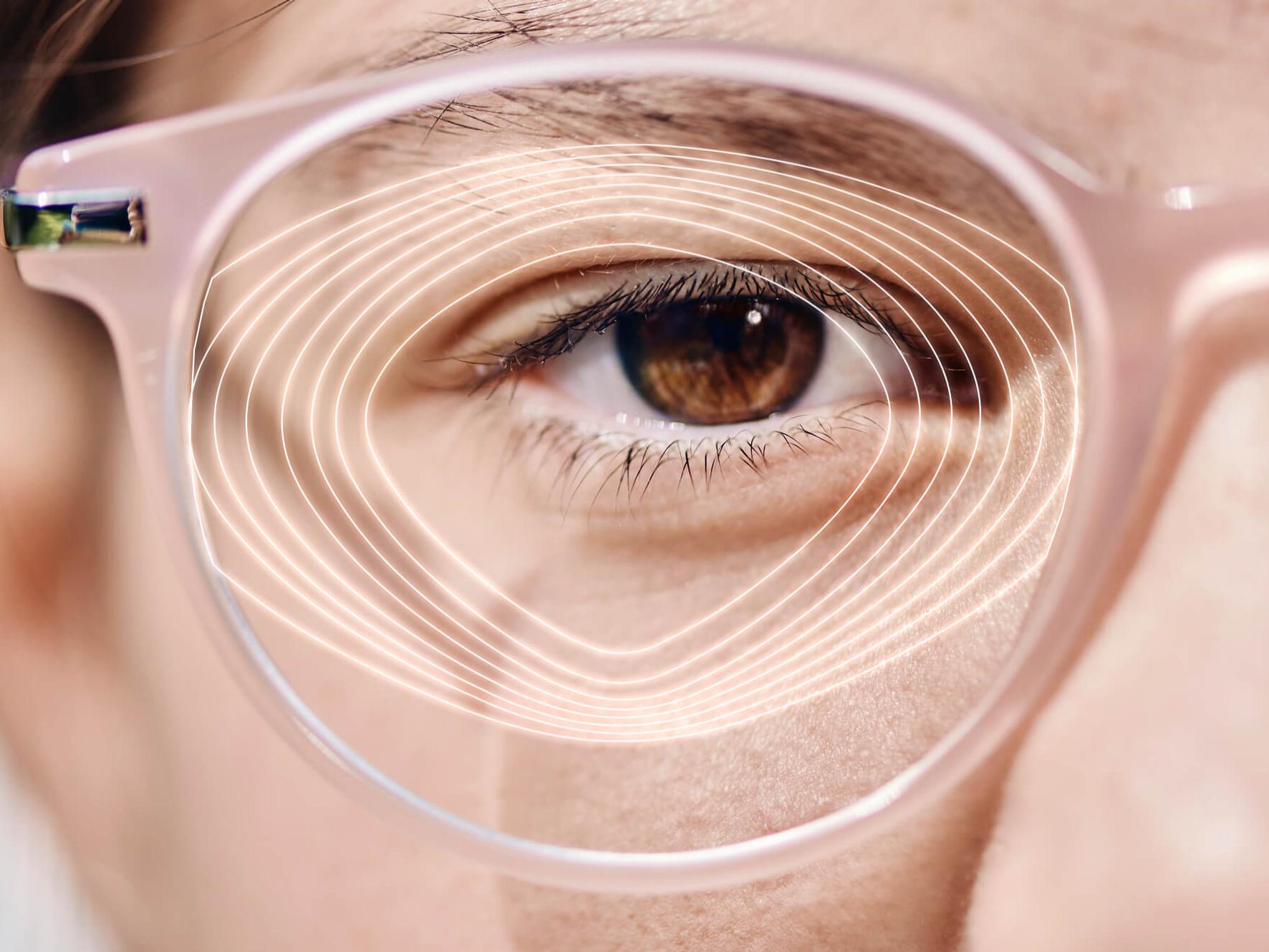 Ilustração da lente ZEISS MyoVision: uma grande zona central suporta a visão à distância, enquanto as extremidades controlam a progressão da miopia.