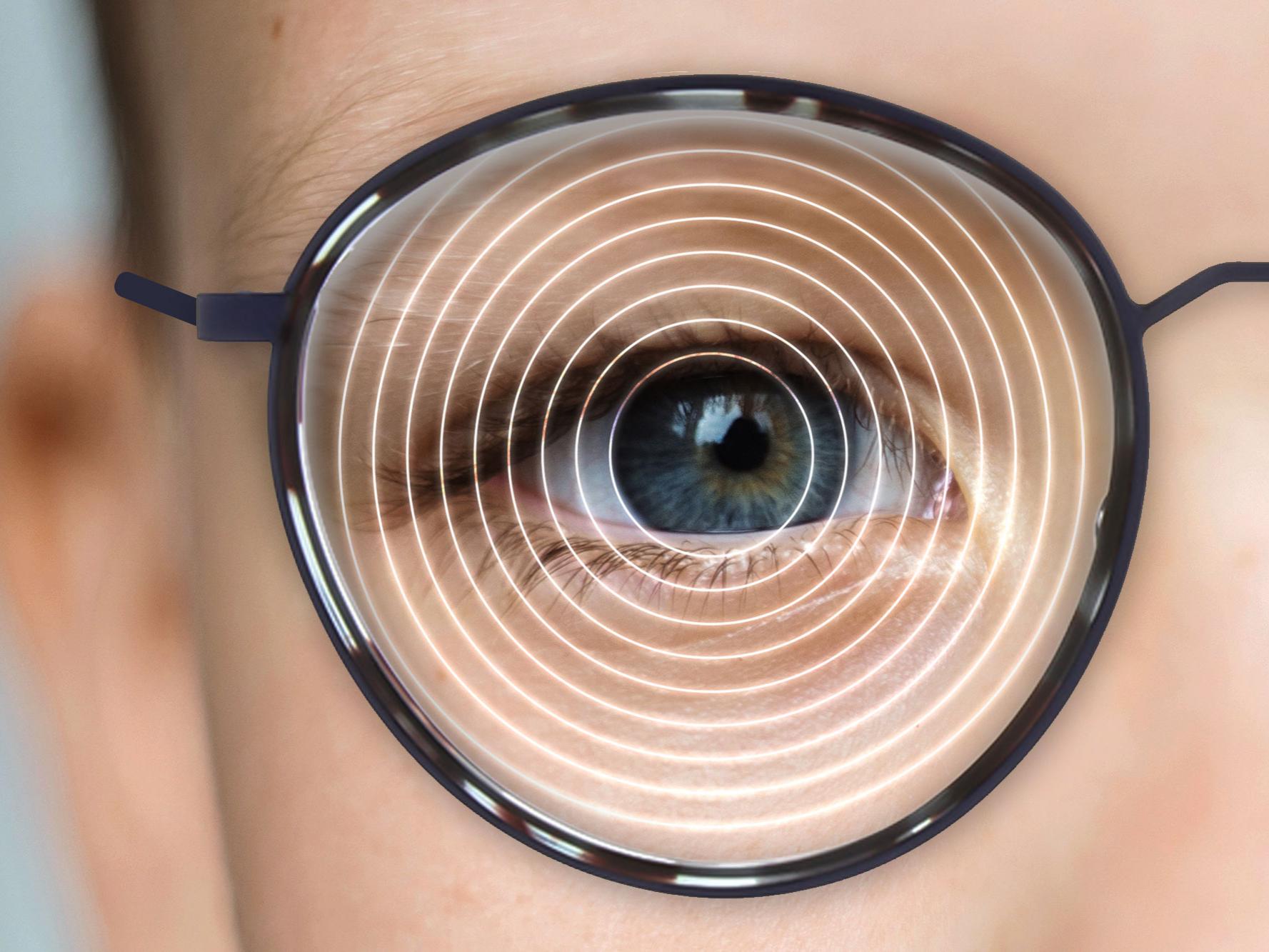 Ilustração da lente ZEISS MyoVision Ace: uma zona central pequena mas suficiente suporta a visão à distância, enquanto as extremidades controlam a progressão da miopia.