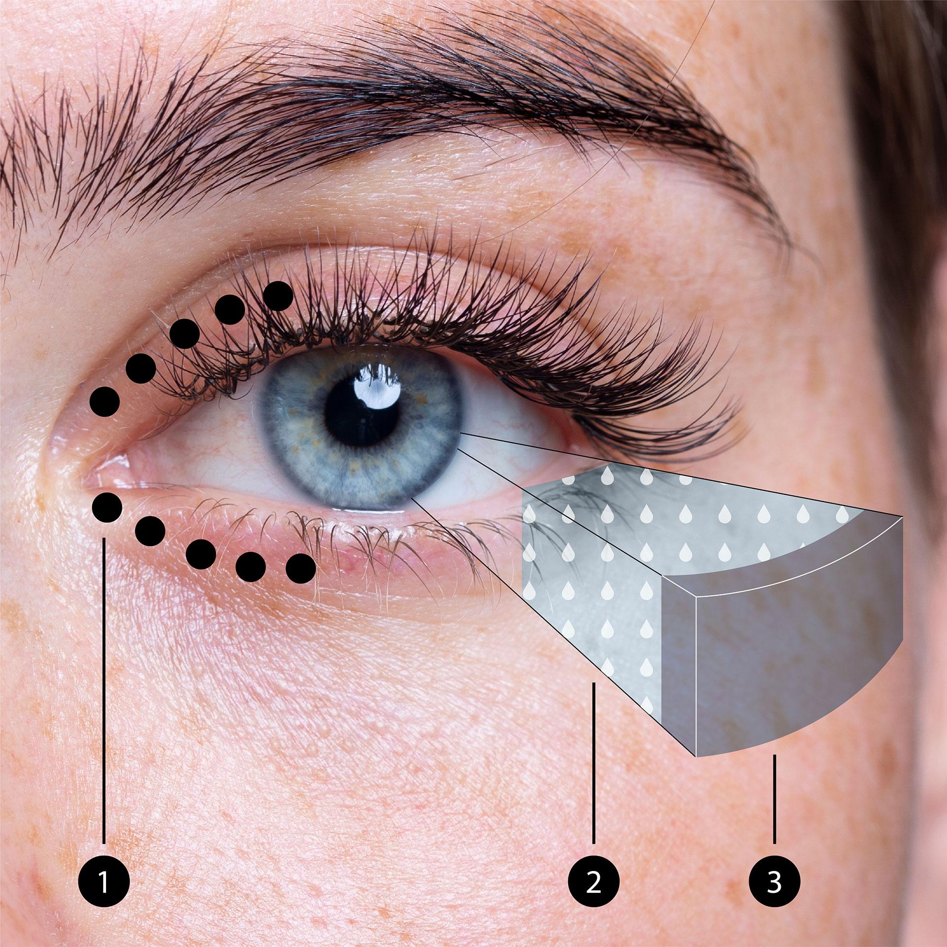 Imagem de um olho mostrando a posição das glândulas meibomianas nas pálpebras e a camada de meibum sobre a secreção lacrimal que recobre o olho.