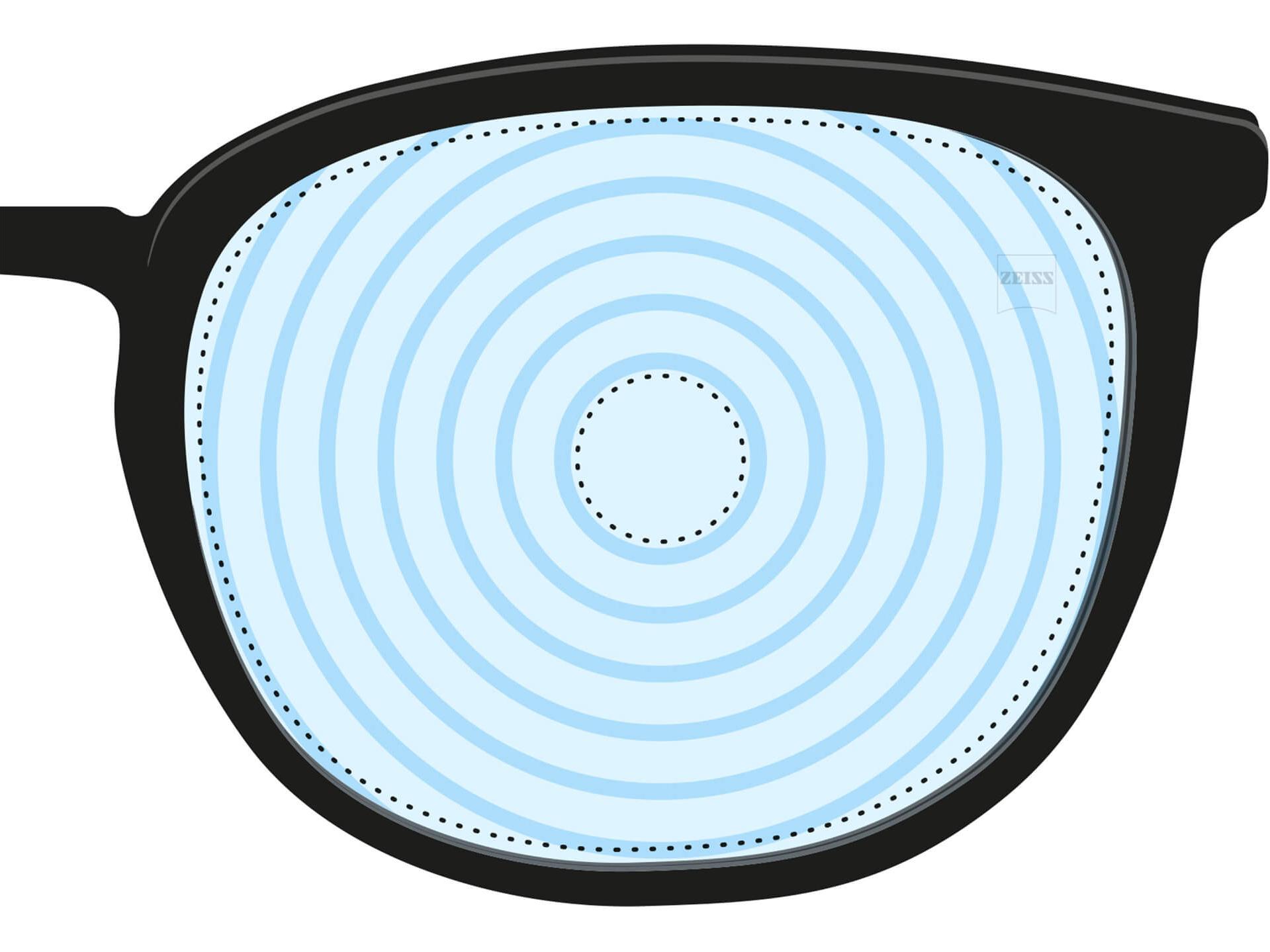 Ilustração de uma lente para miopia. Ela tem círculos concêntricos representando os diferentes graus da lente. É um exemplo de lente projetada para uma finalidade específica.